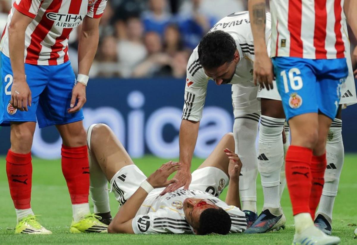 Real Madrid's Spanish defender #02 Dani Carvajal checks on Real Madrid's French forward #10 Kylian Mbappe (BOTTOM) who lies on the pitch with blood on his face after colliding with Girona's Brazilian defender #12 Vitor Reis (not pictured) during the Spanish league football match between Real Madrid CF and Girona FC at the Santiago Bernabeu stadium in Madrid on April 10, 2026.  Thomas COEX / AFP