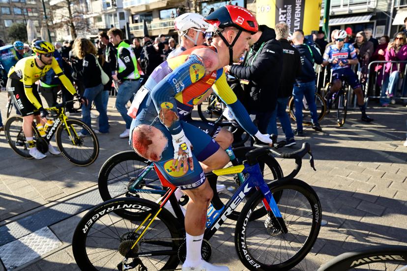 Belgian Edward Theuns of Lidl-Trek pictured after a fall during the 'Classic Brugge-De Panne' men's elite one-day cycling race, 195,6 km from Brugge to De Panne, Wednesday 26 March 2025. BELGA PHOTO DIRK WAEM