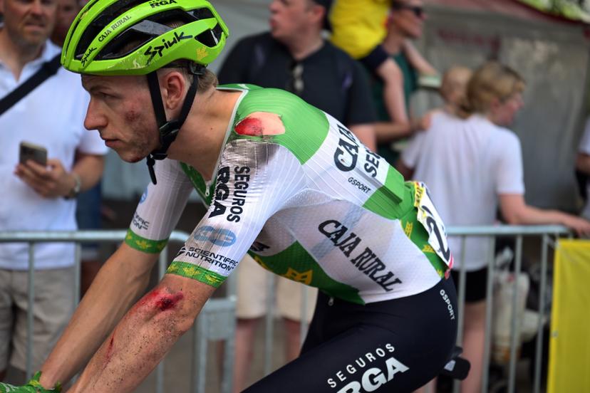 Dutch Alex Molenaar of Caja Rural-Seguros RGA is bruised after a fall at stage 5 of the 2026 Tour de France cycling race, a stage of 158km from Lannemezan to Pau, on Wednesday 08 July 2026. The 113th edition of the Tour de France starts on Saturday 4 July in Barcelona, Spain, and will finish in Paris, France on the 26th of July.  BELGA PHOTO DAVID PINTENS
