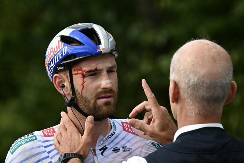 Red Bull - BORA - hansgrohe team's Belgian rider Jordi Meeus receives medical attention after suffering a crash in the final kilometres of the  the 3rd stage of the 112th edition of the Tour de France cycling race, 178.3 km between Valenciennes and Dunkerque (Dunkirk), Northern France, on July 7, 2025.  Loic VENANCE / AFP